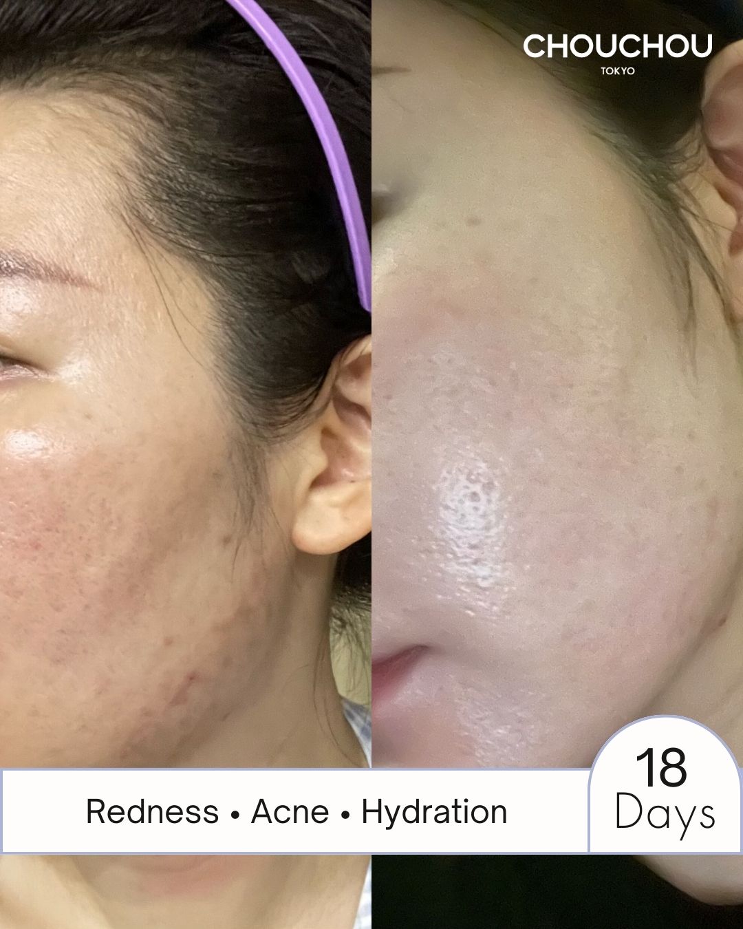 The Radiance Kit